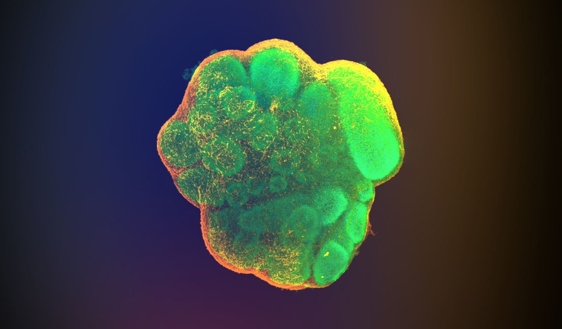Fig 1. Young cerebral organoid.